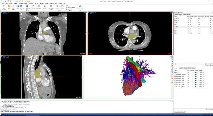 大学生如何选购笔记本电脑？（各大专业电脑推荐）